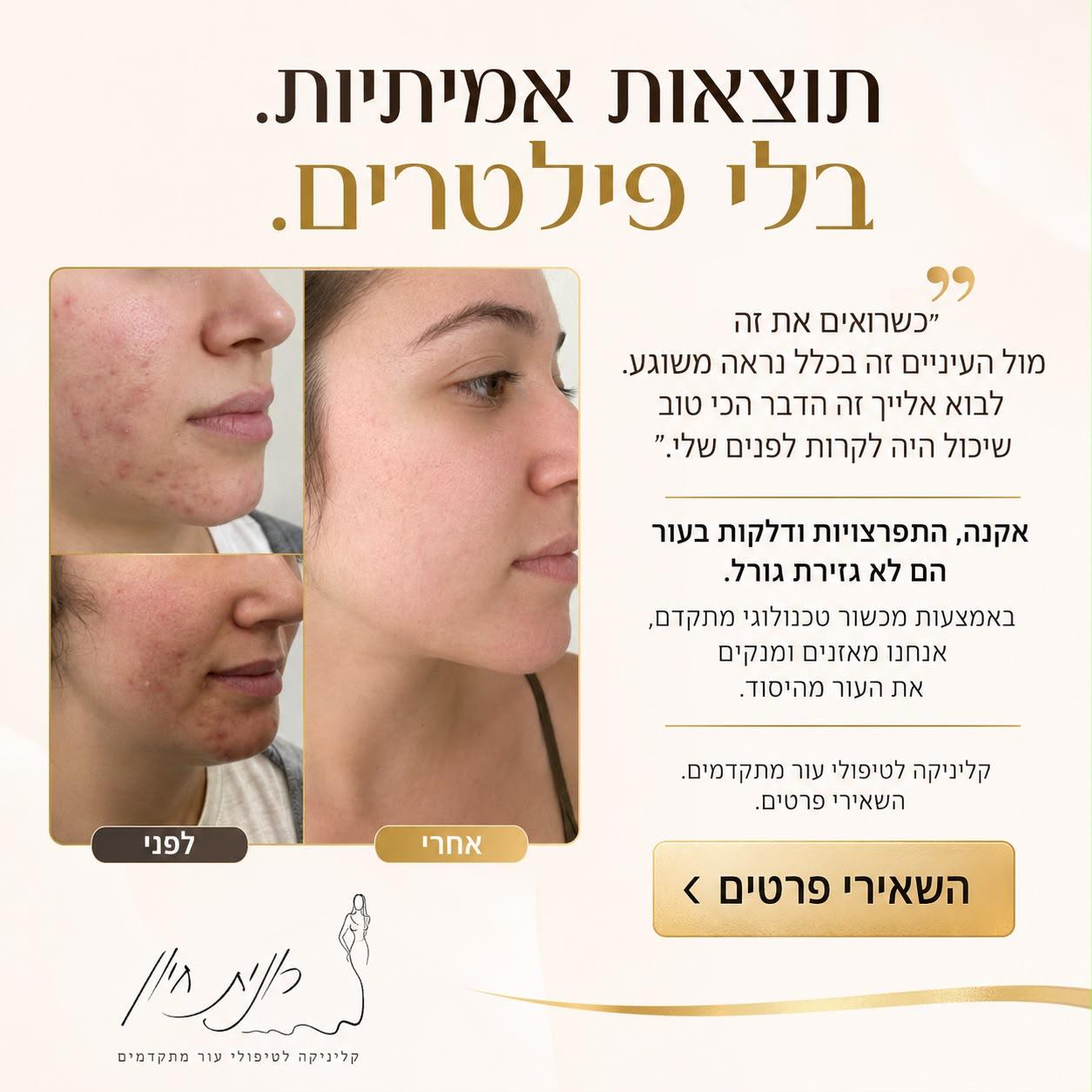 עיצוב פוסט ממותג ל-B-TEC סוכנות שיווק