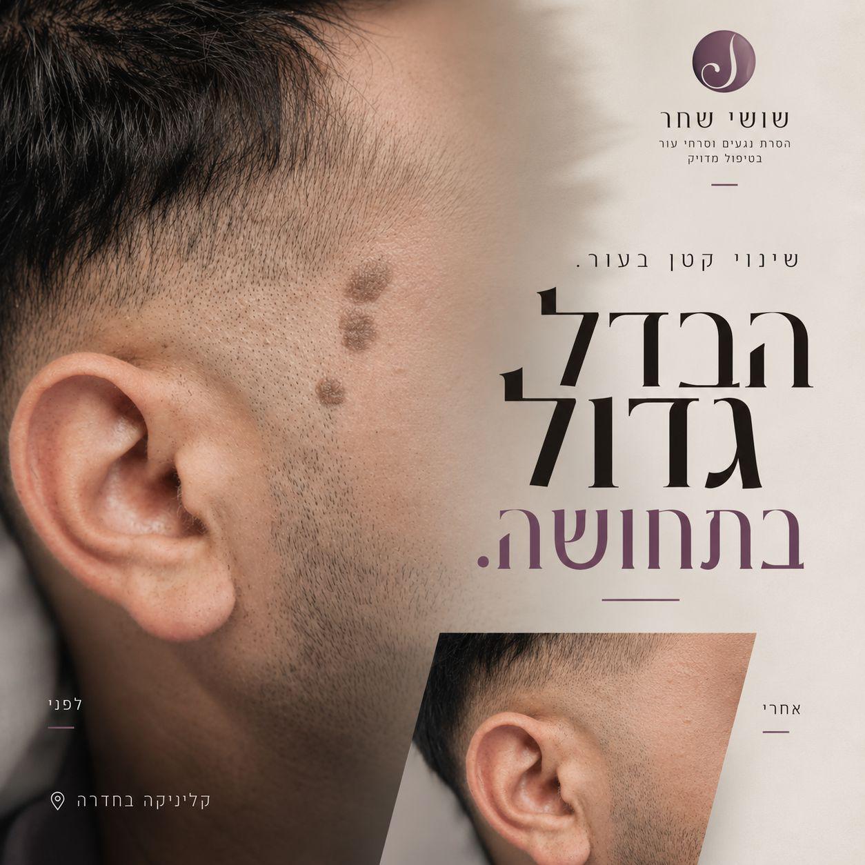 גרפיקה לדוגמא 2